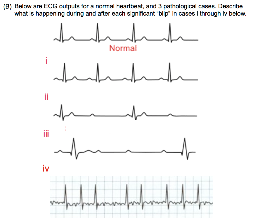 Solved The electrocardiogram, or ECG, tracks the | Chegg.com