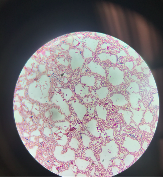 Solved Microbiology bacteria! Identify this 