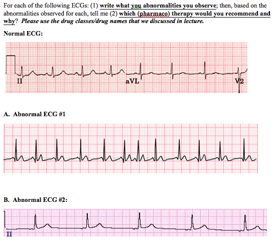 Solved For each of the following ECGs: (1) write what you | Chegg.com