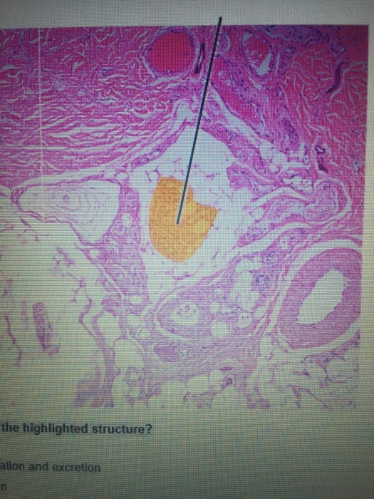 solved-which-structure-is-highlighted-a-sebaceous-ductb-chegg