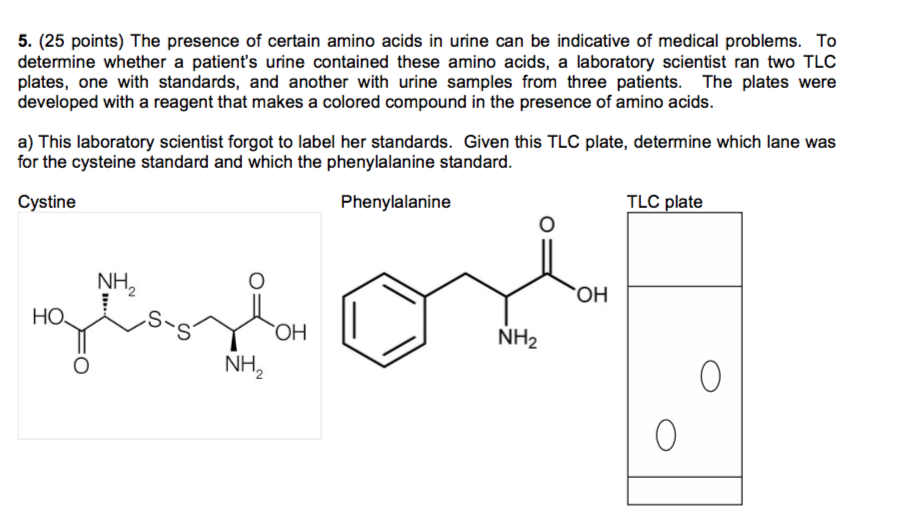 Solved Given the TLC plate above, and the one with urine