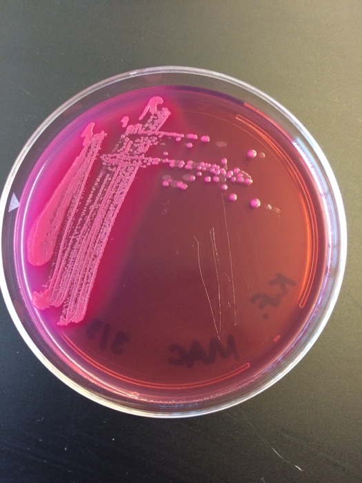 Solved Microbiology question.In lab, I was given three | Chegg.com