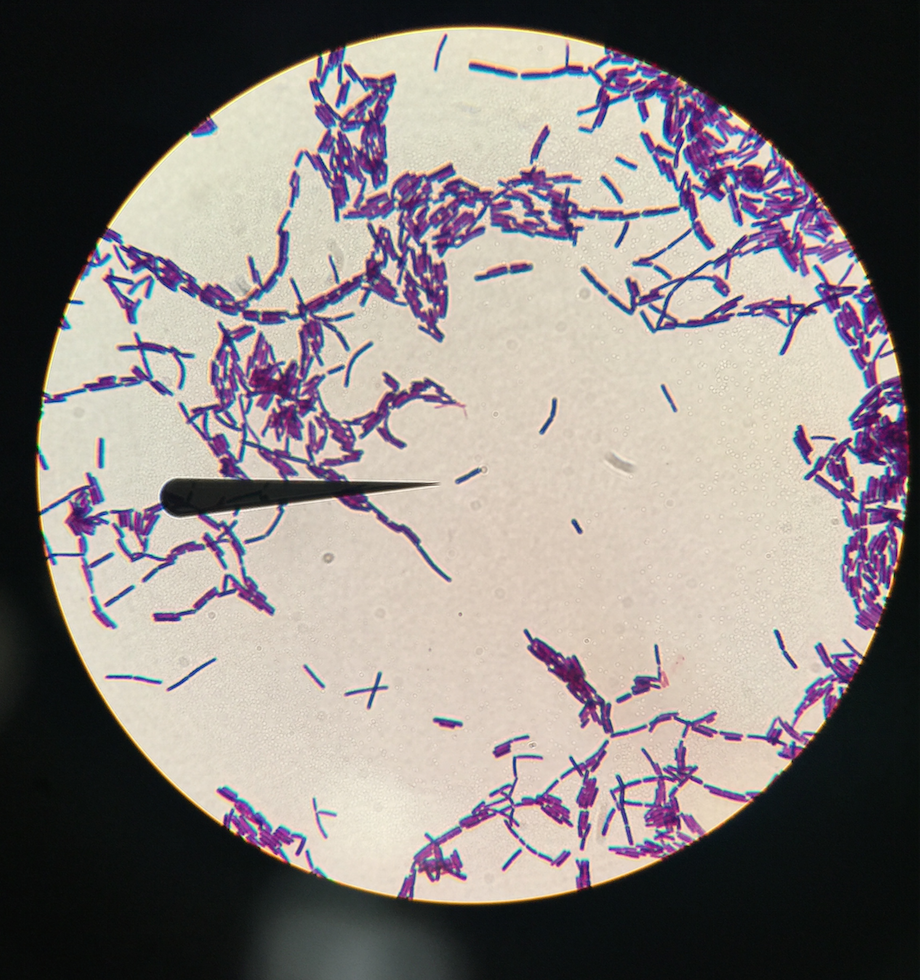 Solved What type of bacteria is this? Shape: | Chegg.com