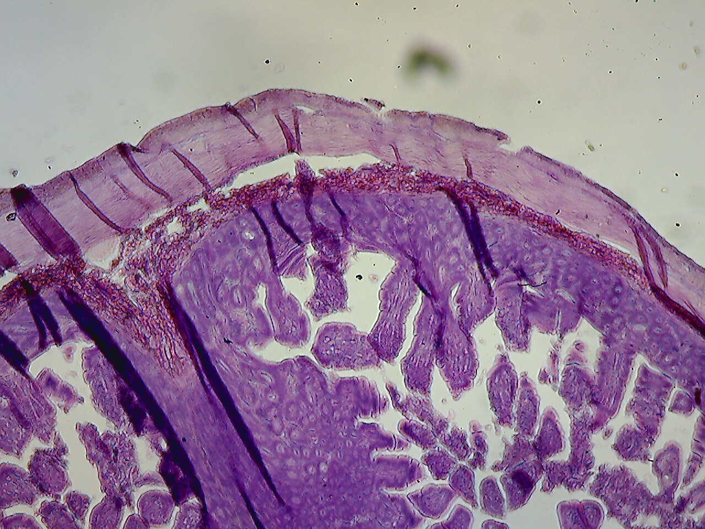 Solved Identify three tissues This is a scalp tissue | Chegg.com