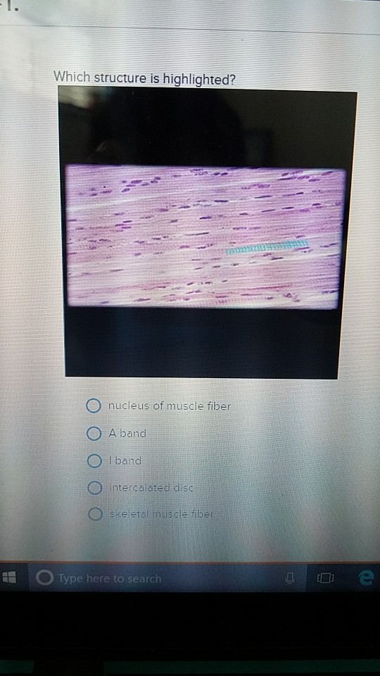 solved-which-structure-is-highlighted-nucleus-of-muscle-chegg