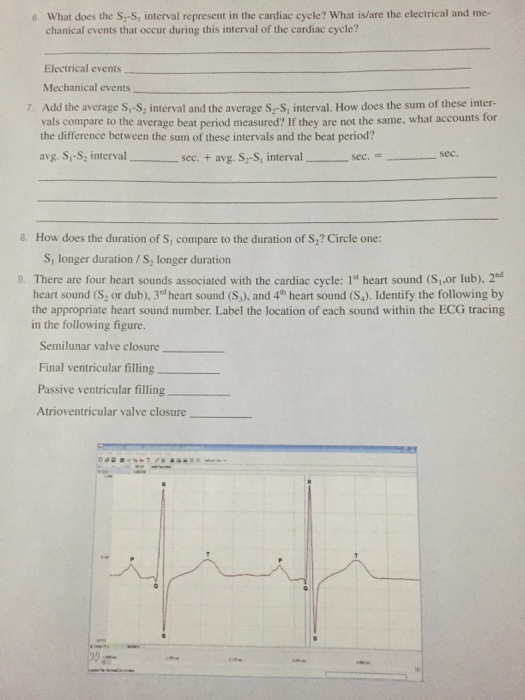 Solved 6. What does the S2S1 interval represent in the