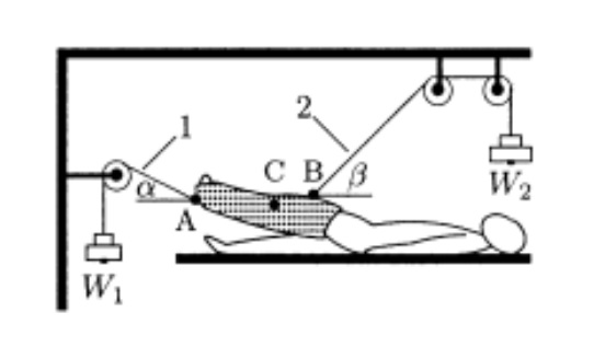 Solved The split Russell traction mechanism is an orthopedic | Chegg.com