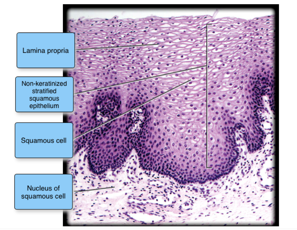 Stratified Squamous Keratinized Epithelium Labeled