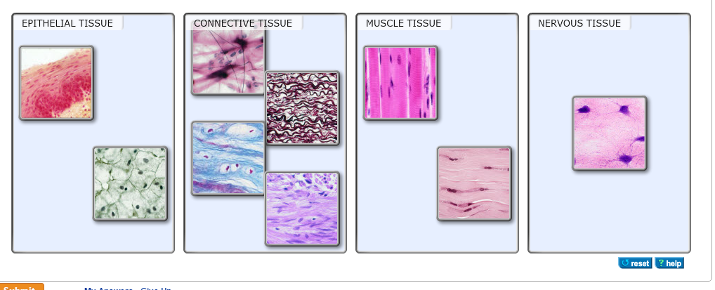 Solved I'm supposed to label the tissues according to their | Chegg.com