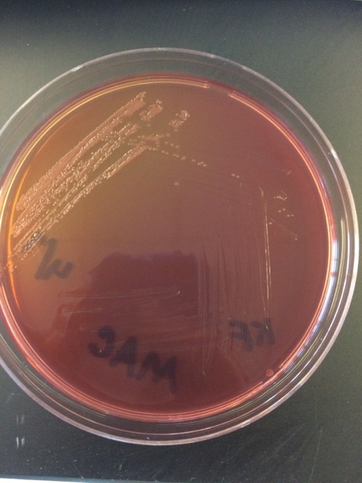 Solved Microbiology question.In lab, I was given three | Chegg.com