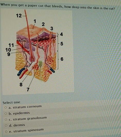Solved When you get a paper cut that bleeds, how deep into | Chegg.com