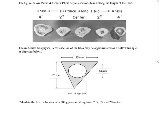 Solved Cortical Bone Is One Of The Two Types Of Bone Tissue | Chegg.com