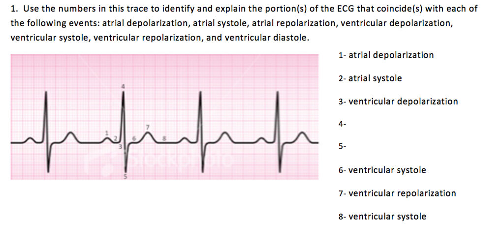 Systole Ecg