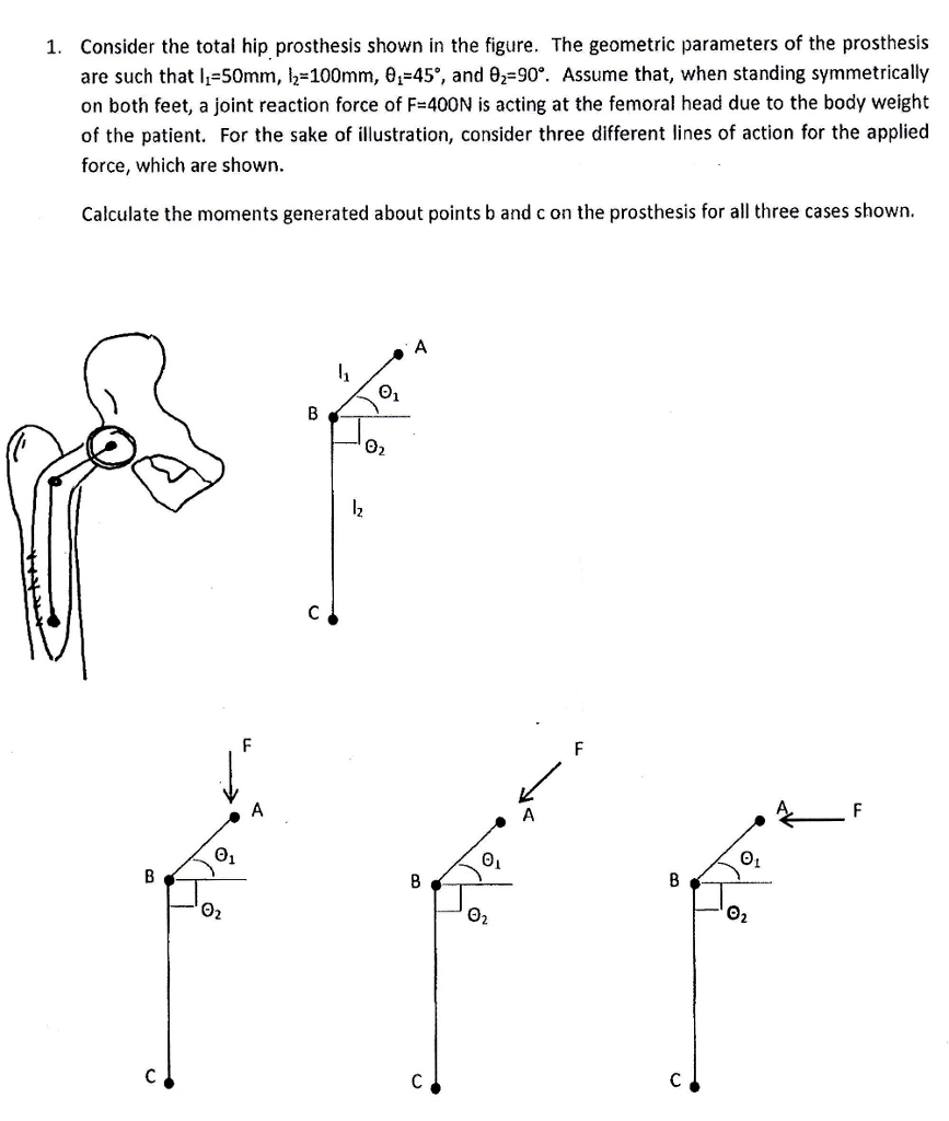 Solved 1. Consider the total hip prosthesis shown in the | Chegg.com