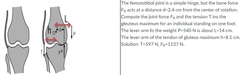 Solved The femorotibial joint is a simple hinge, but the | Chegg.com