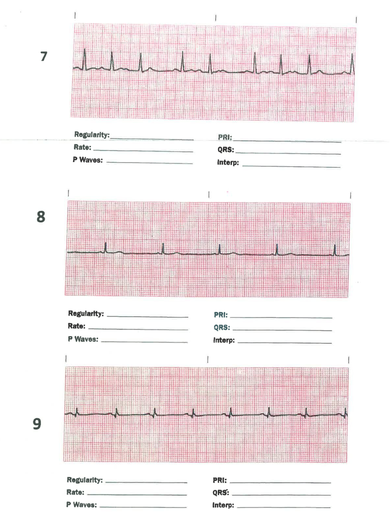 Solved Regularlty: Rate: P Waves: PRI: QRS Interp: | Chegg.com