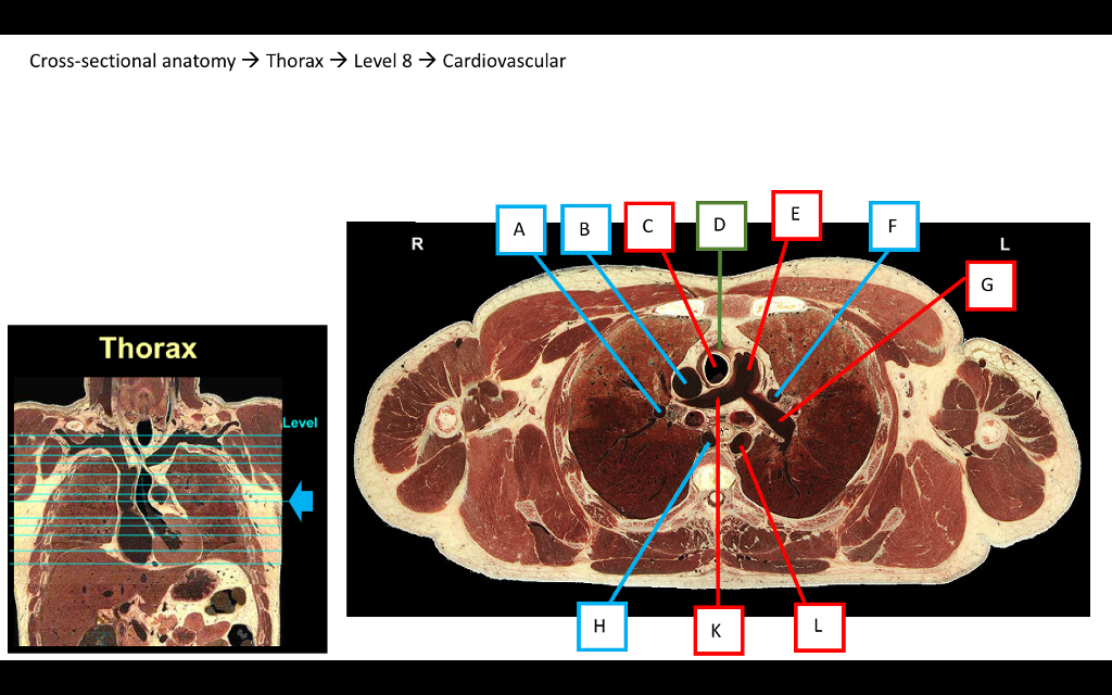 Solved: Cross-sectional Anatomy → Head & Neck-) Level 4 He... | Chegg.com