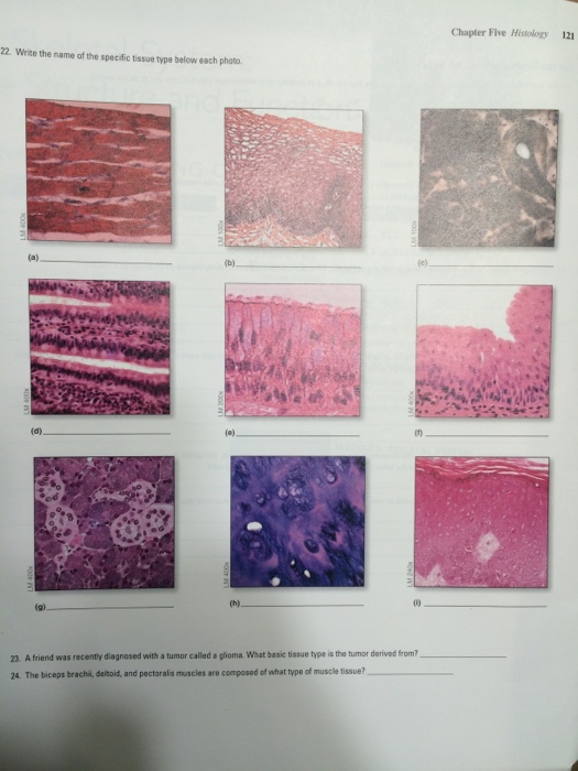 Solved Write the name of the specific tissue type below each | Chegg.com