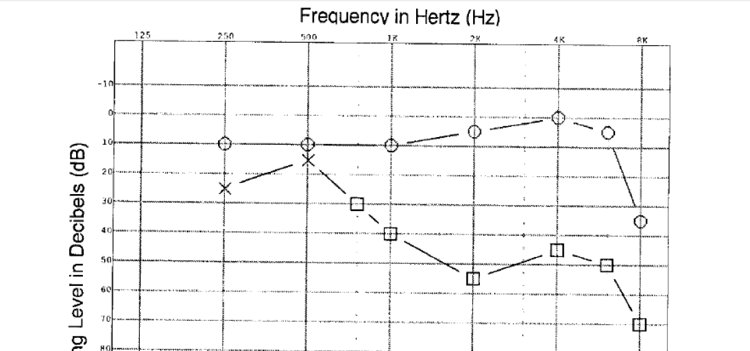 Digital Signal Processing The result of an audiogram | Chegg.com