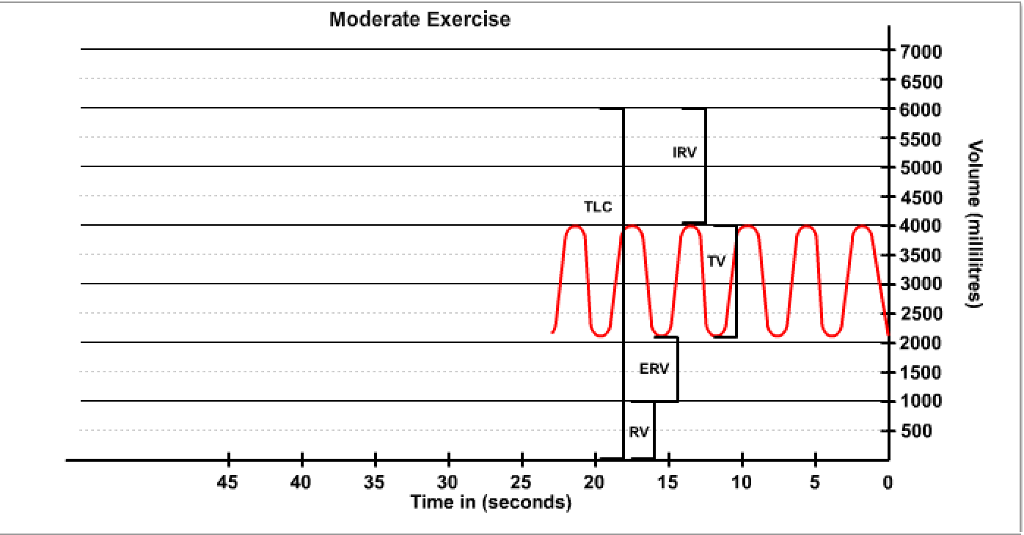 Solved Lab Report Experiment Data Patient Type Heavy