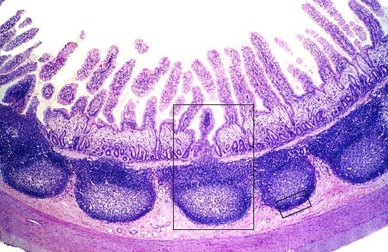 Solved Identify the lymphoid organ. lymph node | Chegg.com