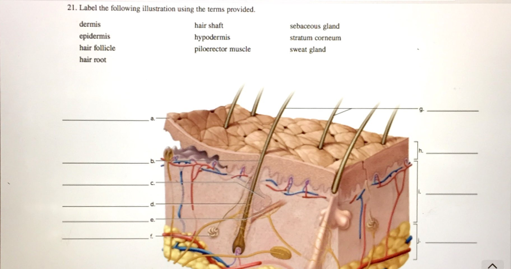 Solved 21. Label the following illustration using the terms | Chegg.com
