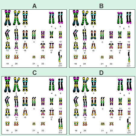 Solved . Examine The Four Karyotypes Below What Is The | Chegg.com