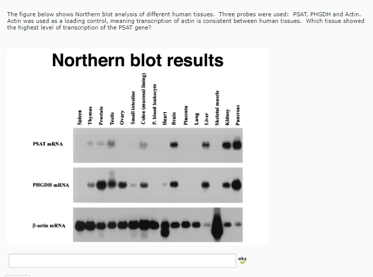 northern blot analysis biofilm