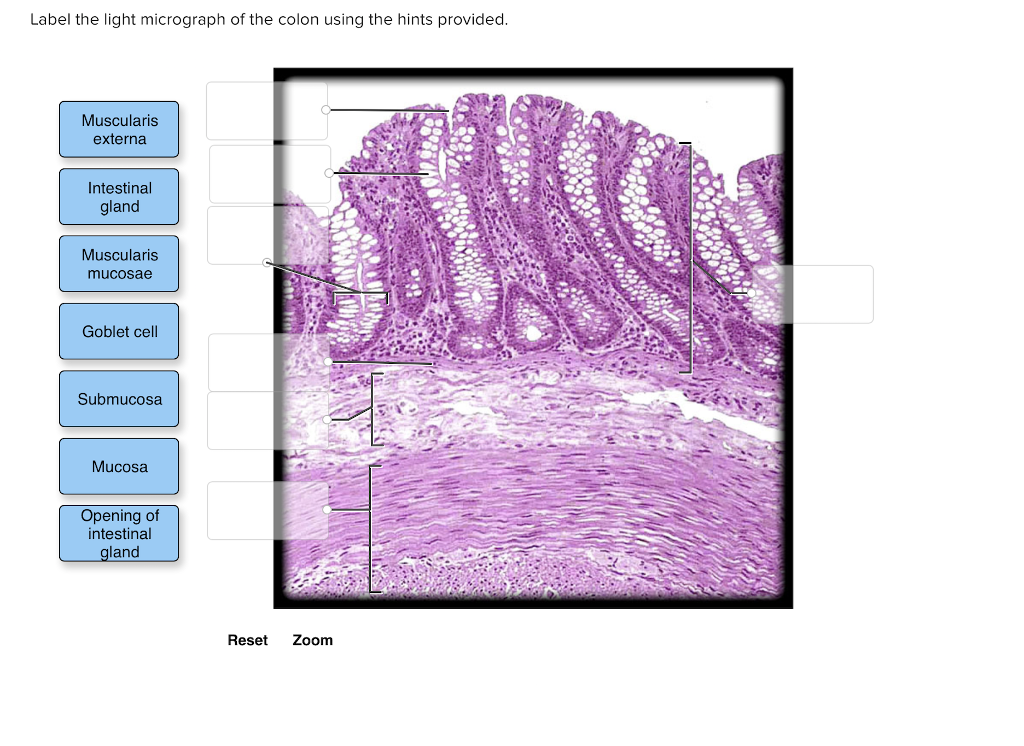 Solved Label the light micrograph of the colon using the