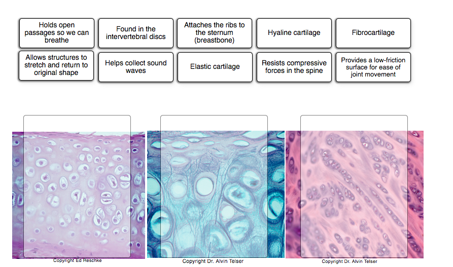 Determine which connective tissue type each image