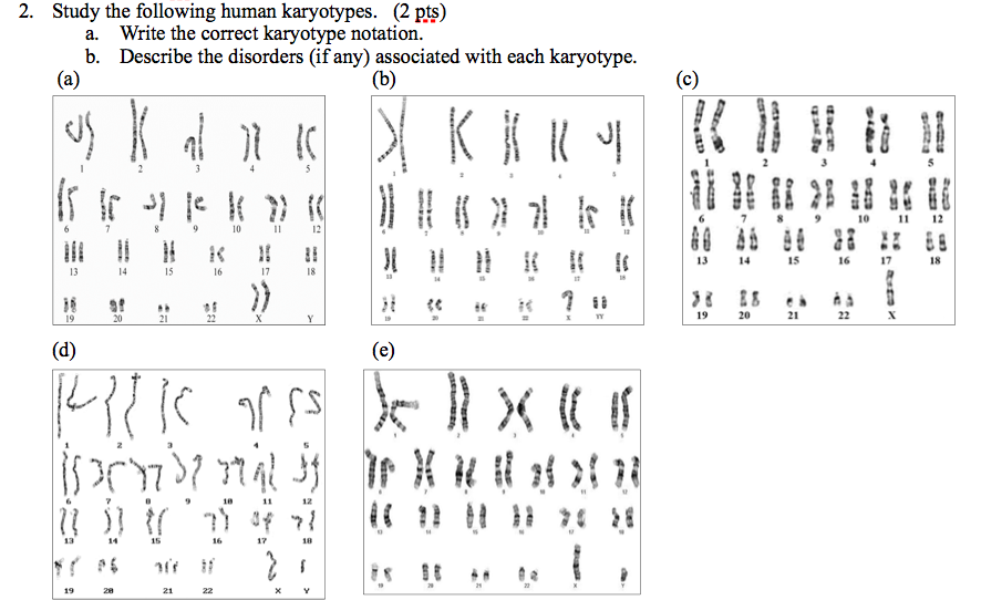 Solved (2 Pts) 2. Study The Following Human Karyotypes. A. | Chegg.com