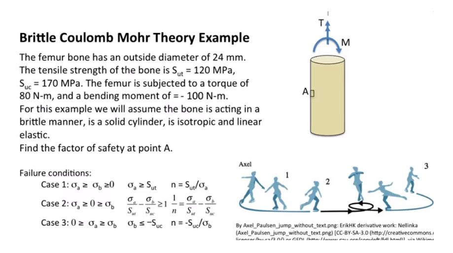 Solved Brittle Coulomb Mohr Theory Example The femur bone